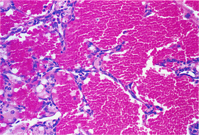 Color Atlas of Neoplastic and Non-neoplastic Lesions in Aging Mice ...